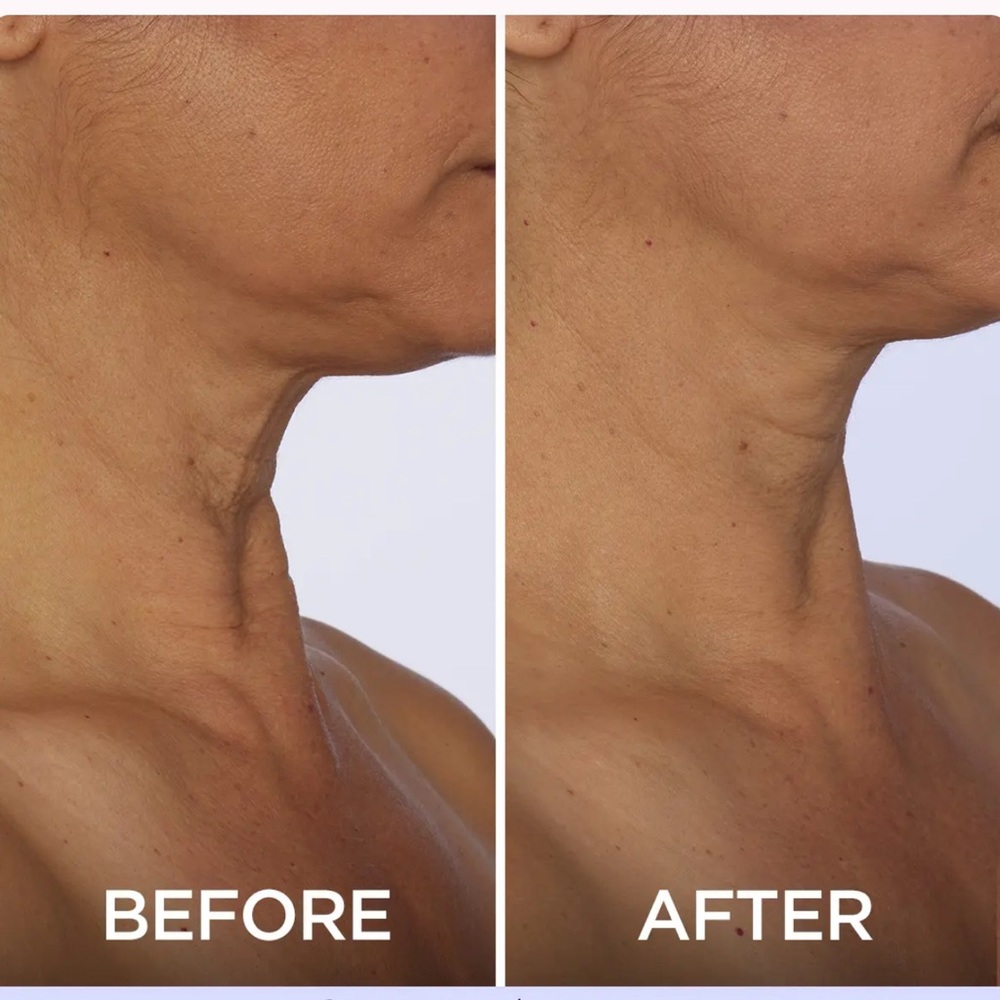 Brand New Set of 3 Go Pure - Tighten and Lift Neck Cream - Picture 11 of 12